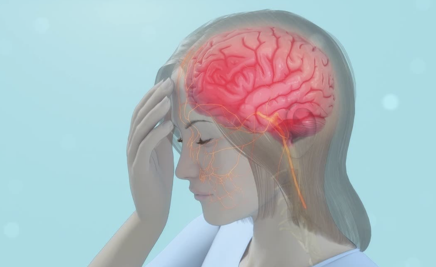 migraine.png