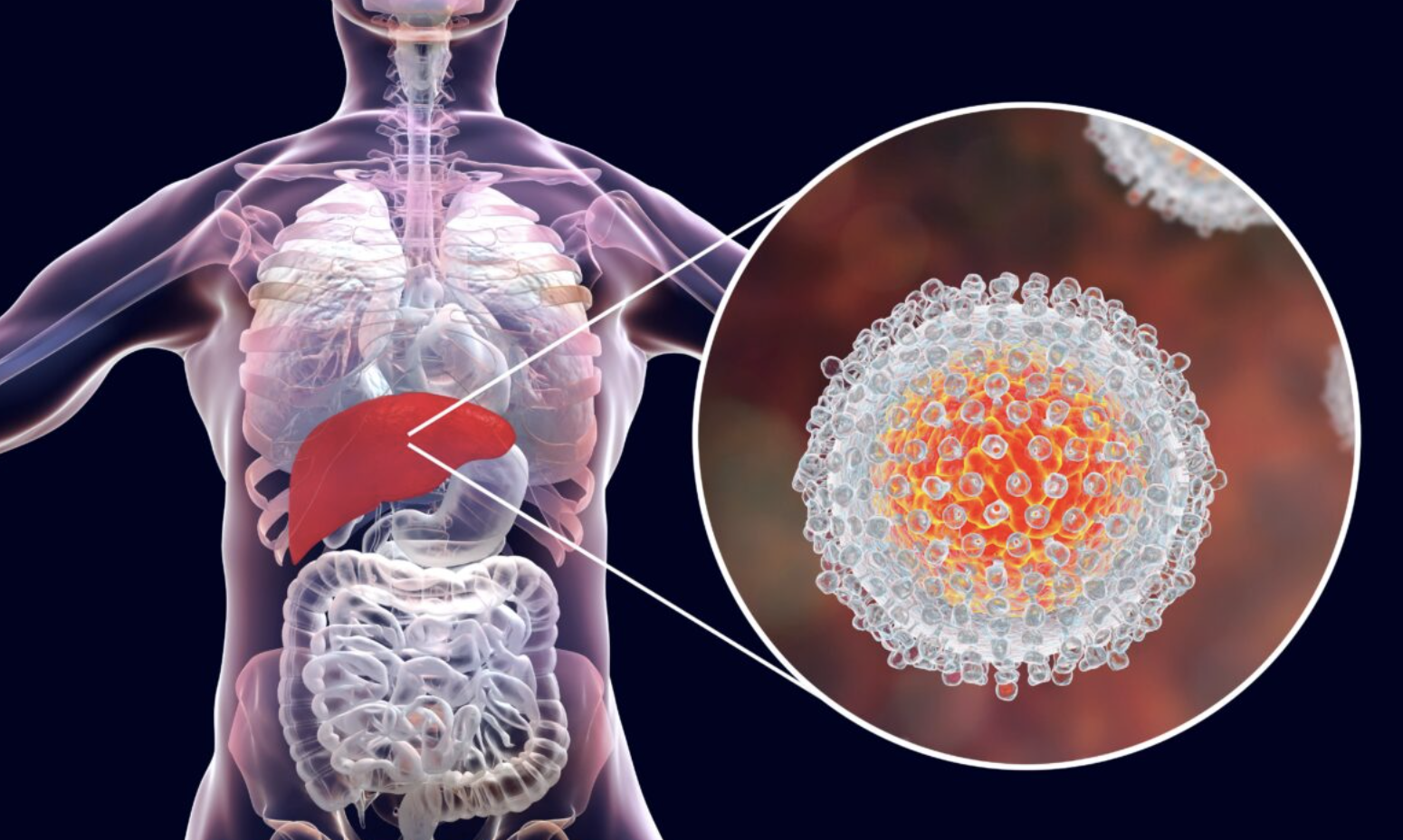 hepatitis.png hepatitis.png